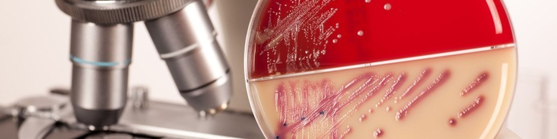 Header: Fungal Skin Infections