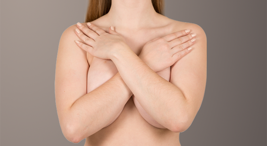 Brustverkleinerung: Frau verschränkt Arme vor der Brust