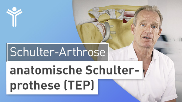 Schulter-Arthrose - anatomische Schulterprothese (TEP)