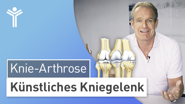 Knie-Arthrose - Künstliches Kniegelenk