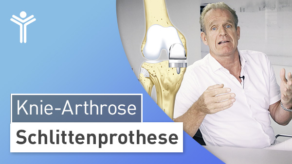 Knie-Arthrose - Schlittenprothese