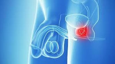 Benign prostate enlargement: symptom check