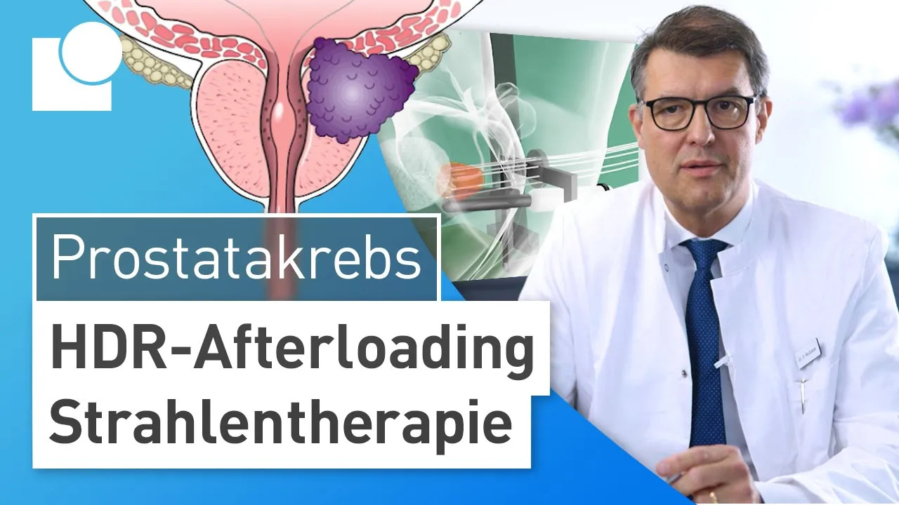 HDR-Afterloading: Fortgeschrittenen & aggressiven Prostatakrebs ohne OP erfolgreich heilen